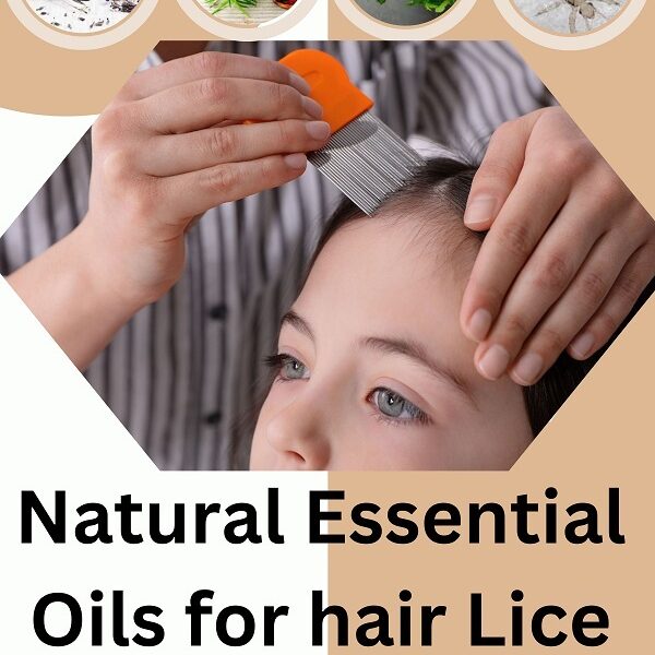 “Natural Essential Oils for hair Lice Prevention: best solution”