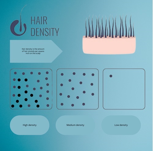 hair density chart